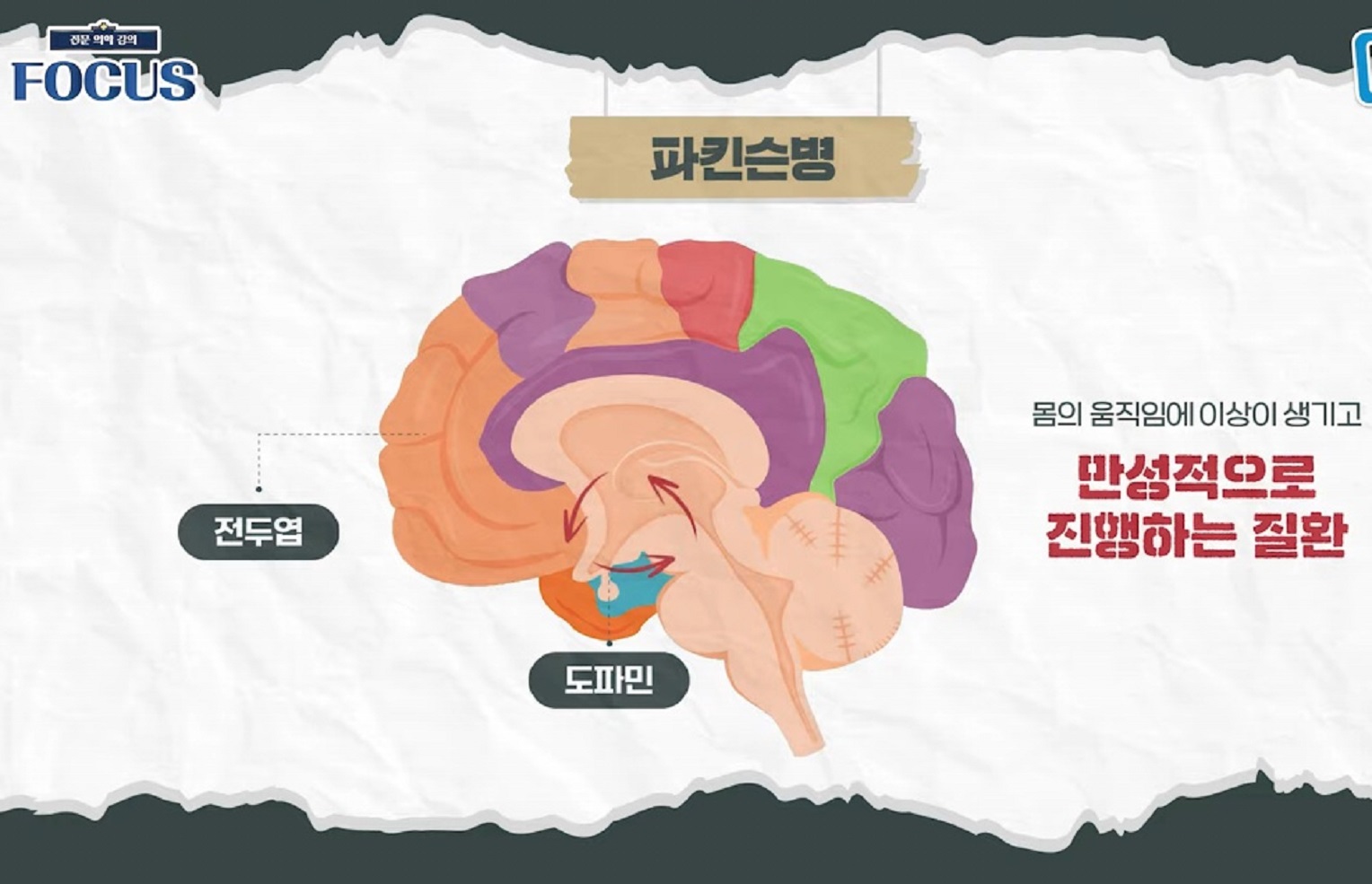 명의-파킨슨-김한준-교수
