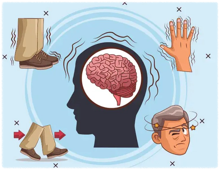 파킨슨병-증상-원인