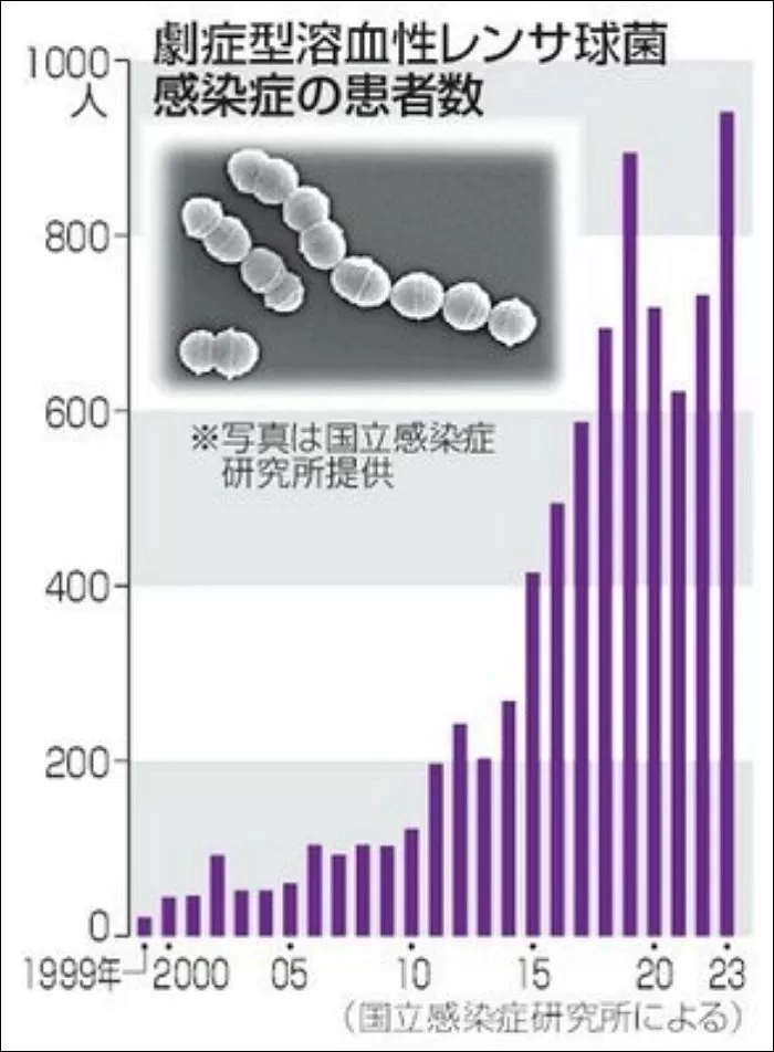일본 전염병 유행 이유와 상황