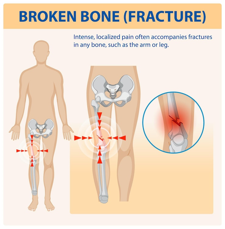 인공관절수술 비용
