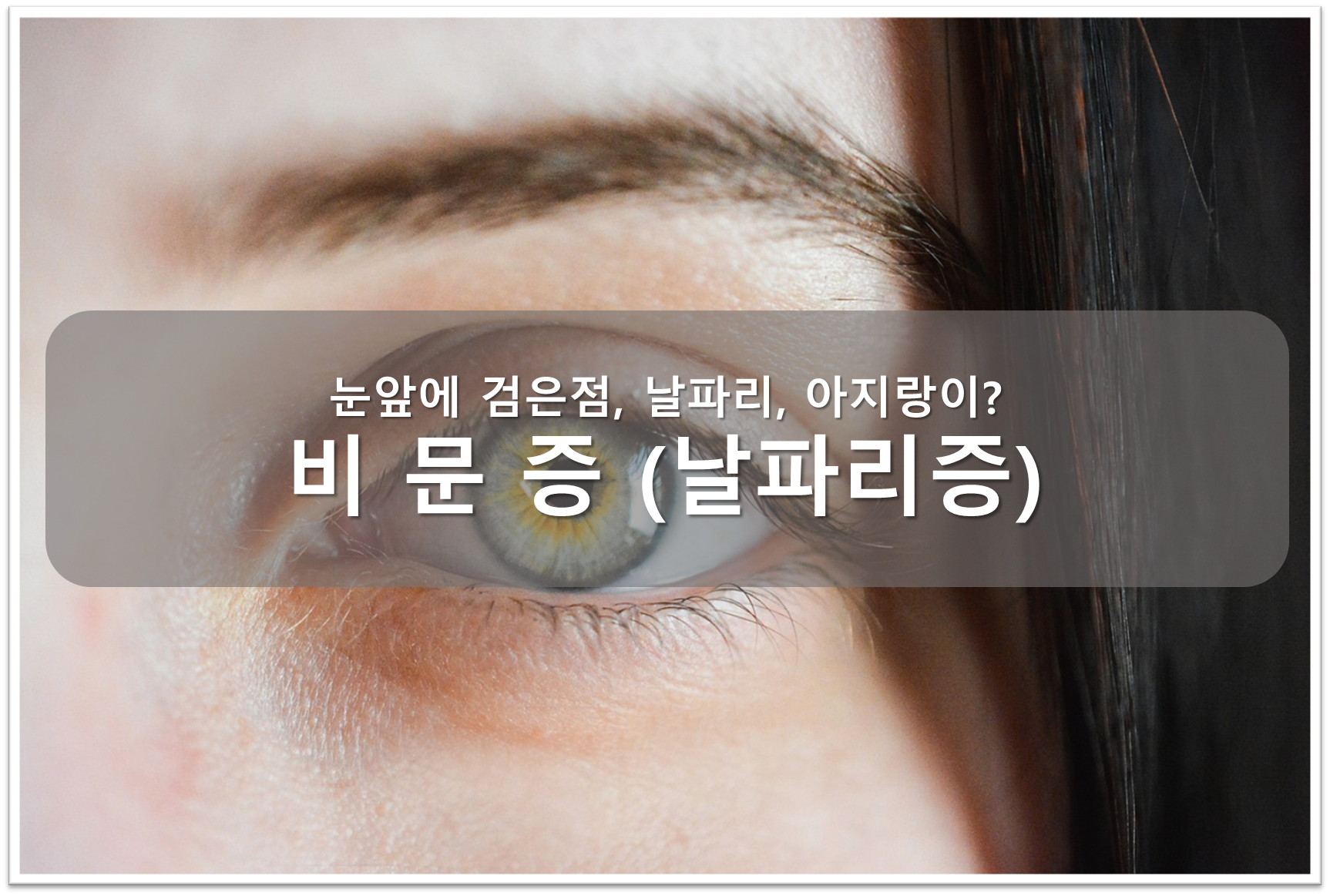 비문증