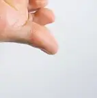 손발 저림 원인