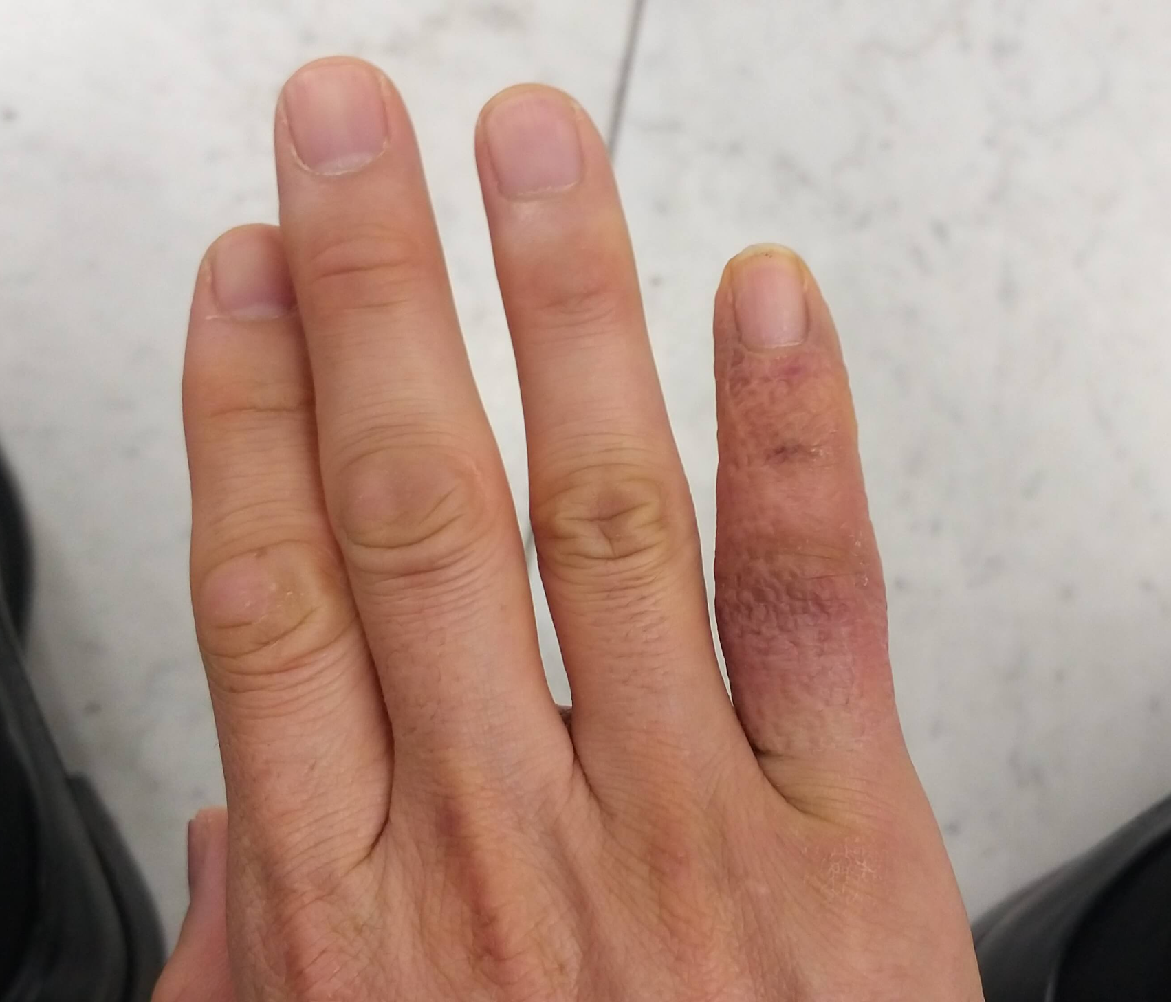 2월3일손가락촬영한사진1