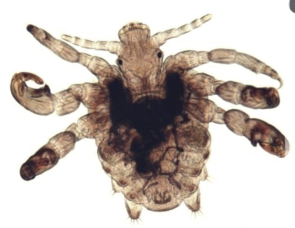 사면발이: 증상, 치료 방법, 그리고 전염성