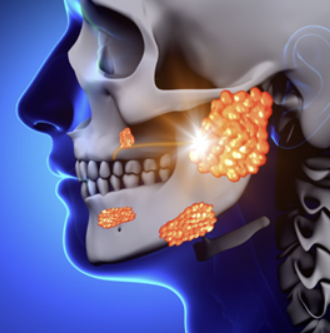 타석증이란, 타석증 증상 수술 치료, 수술입원기간 알아보기(최신)
