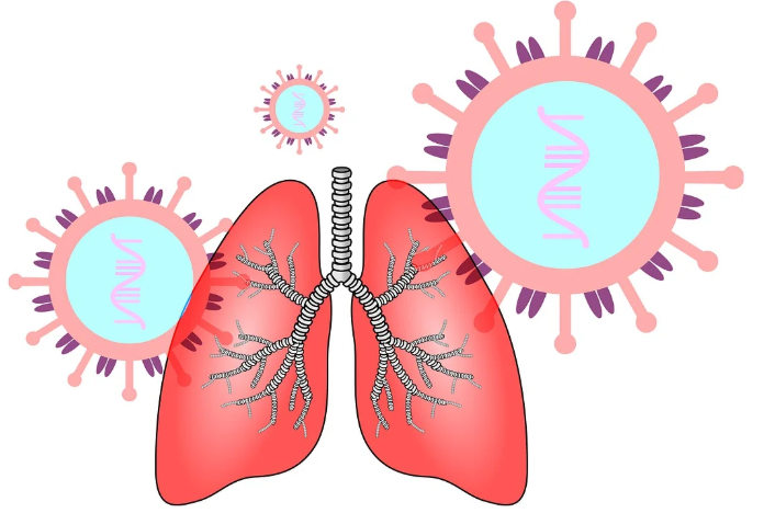 성인간호학 급성 호흡기 질환 환자의 간호 개념 및 원인 주요 증상과 진단
