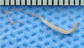 구충제 복용 시기와 방법