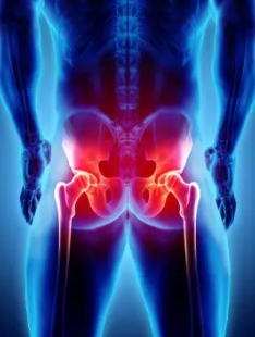 사타구니 통증 원인