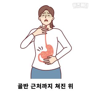 위하수증