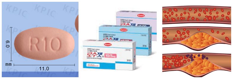 로수젯정, 고지혈증 사진