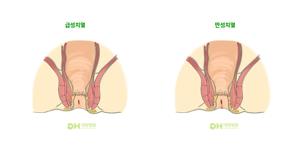 항문 괄약근