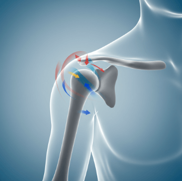 오십견 증상 자가진단 및 대응 방법12