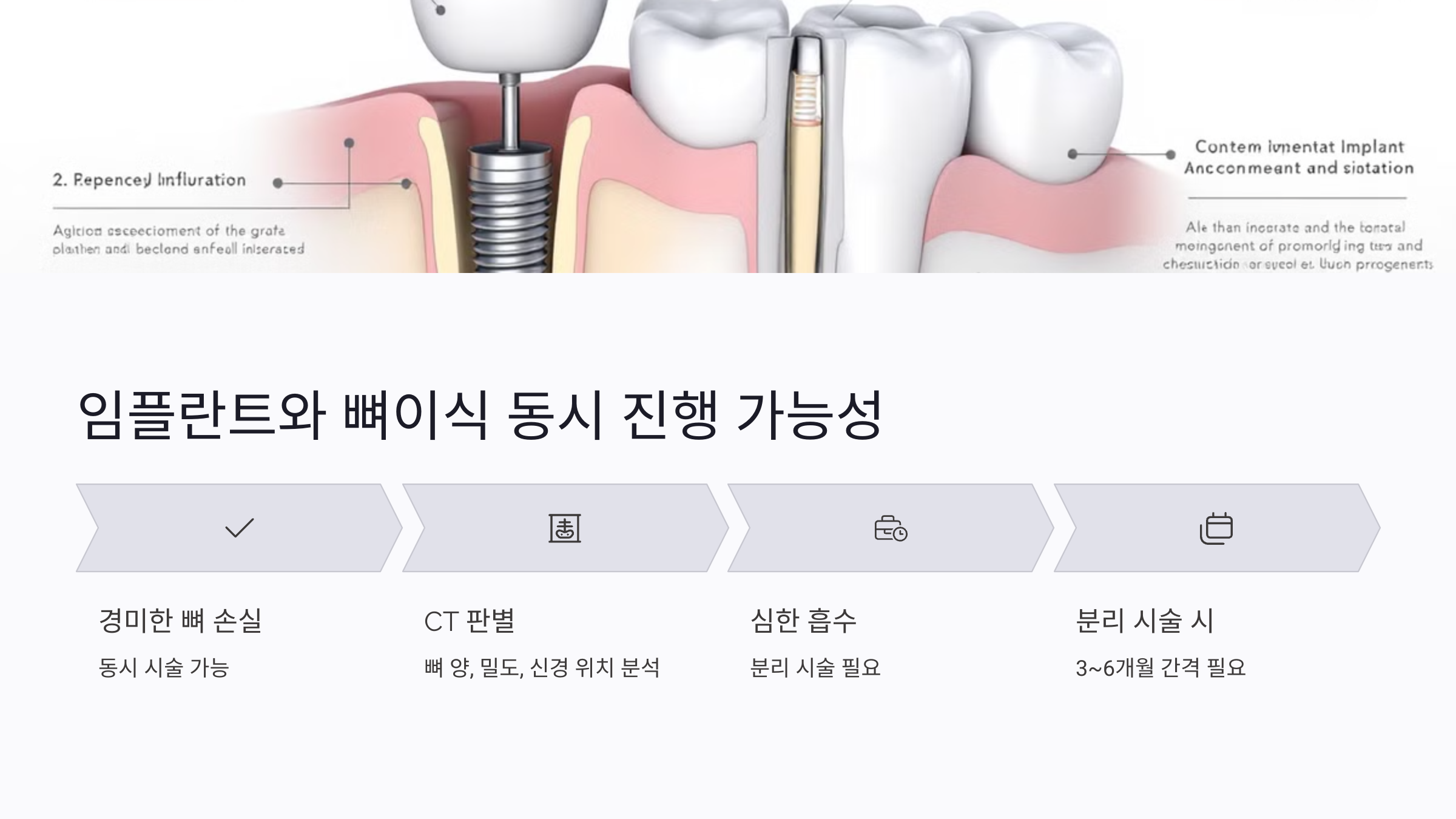 인공뼈이식이 임플란트 성공률에 미치는 영향