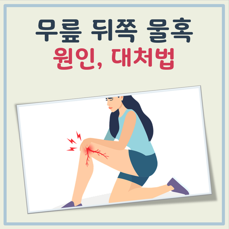 무릎 뒤쪽 물혹 대표 이미지