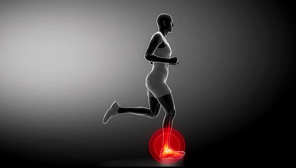 명의 발목 관절