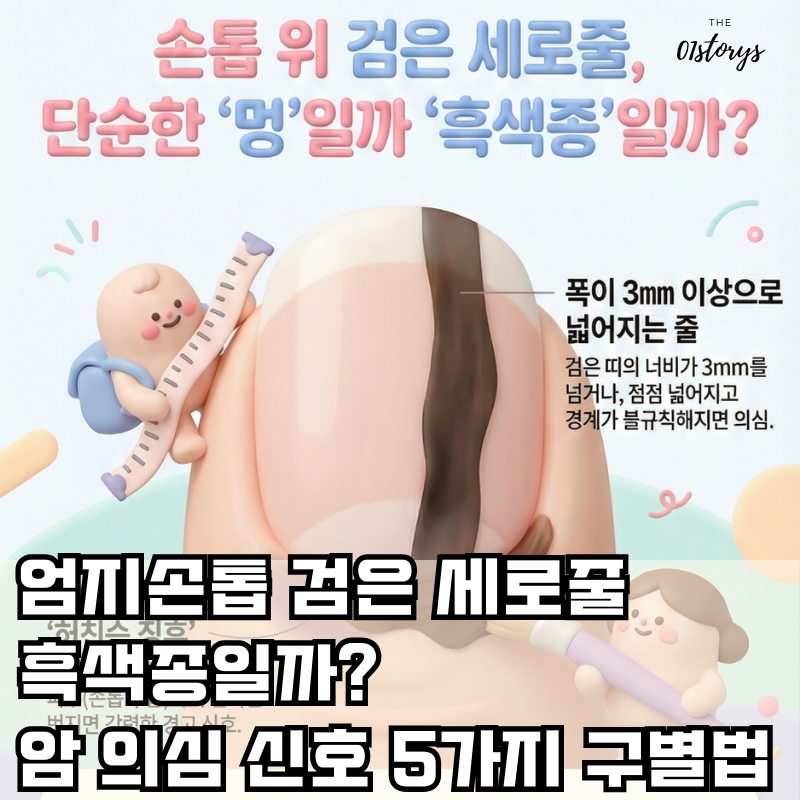 손톱-검은-세로줄-엄지손톱-흑색종-구별법-썸네일