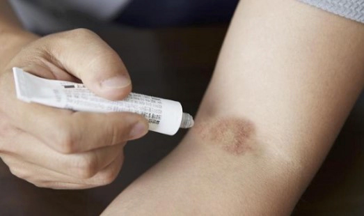 아토피 가려움증 해소방법 11가지