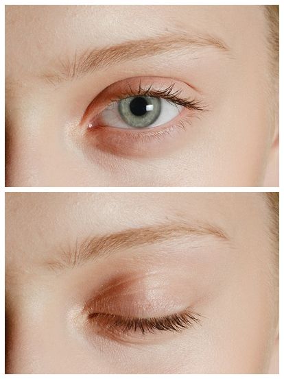 50대 눈 영양제 추천