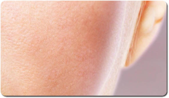 레드 이레이징 크림 효과