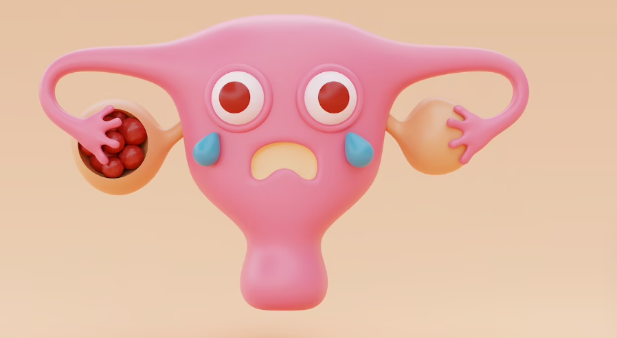 칸디다 질염의 치료방법 방사선 요법