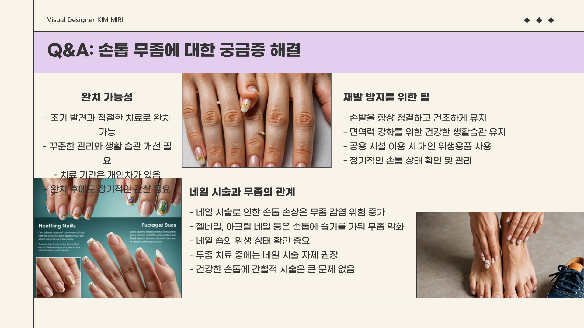손톱 무좀