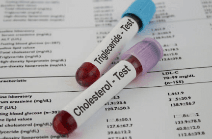 중성지방 낮추는 방법, 중성지방 정상수치