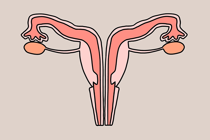 기형적인-자궁의-모습