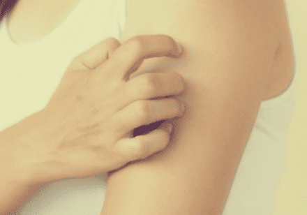 팔을-긁고있는-사람