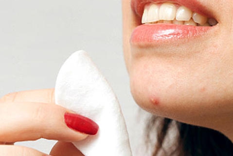 부위별 여드름 원인