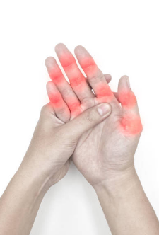 관절염 초기증상, 치료법, 관절염에 좋은 음식 총정리 (2024ver)