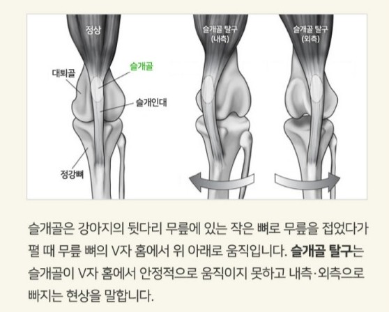 슬개골탈구