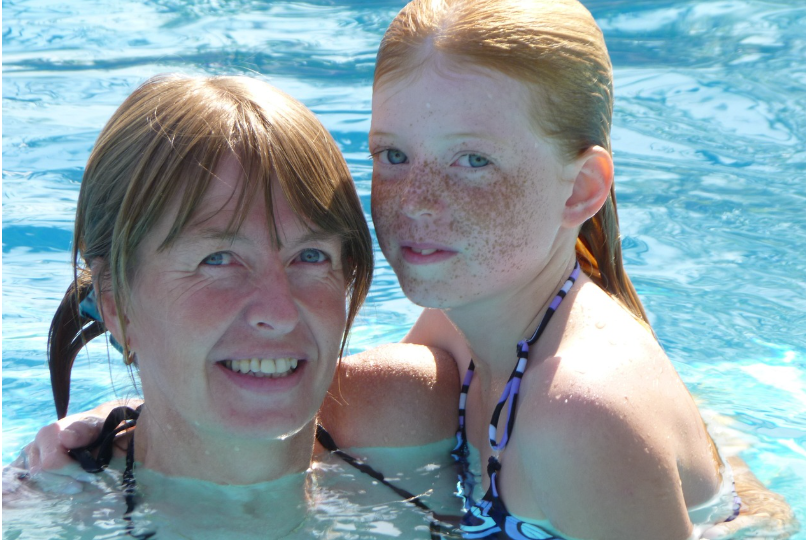 주근깨는 자외선 노출시 더 많아질 수 있다.