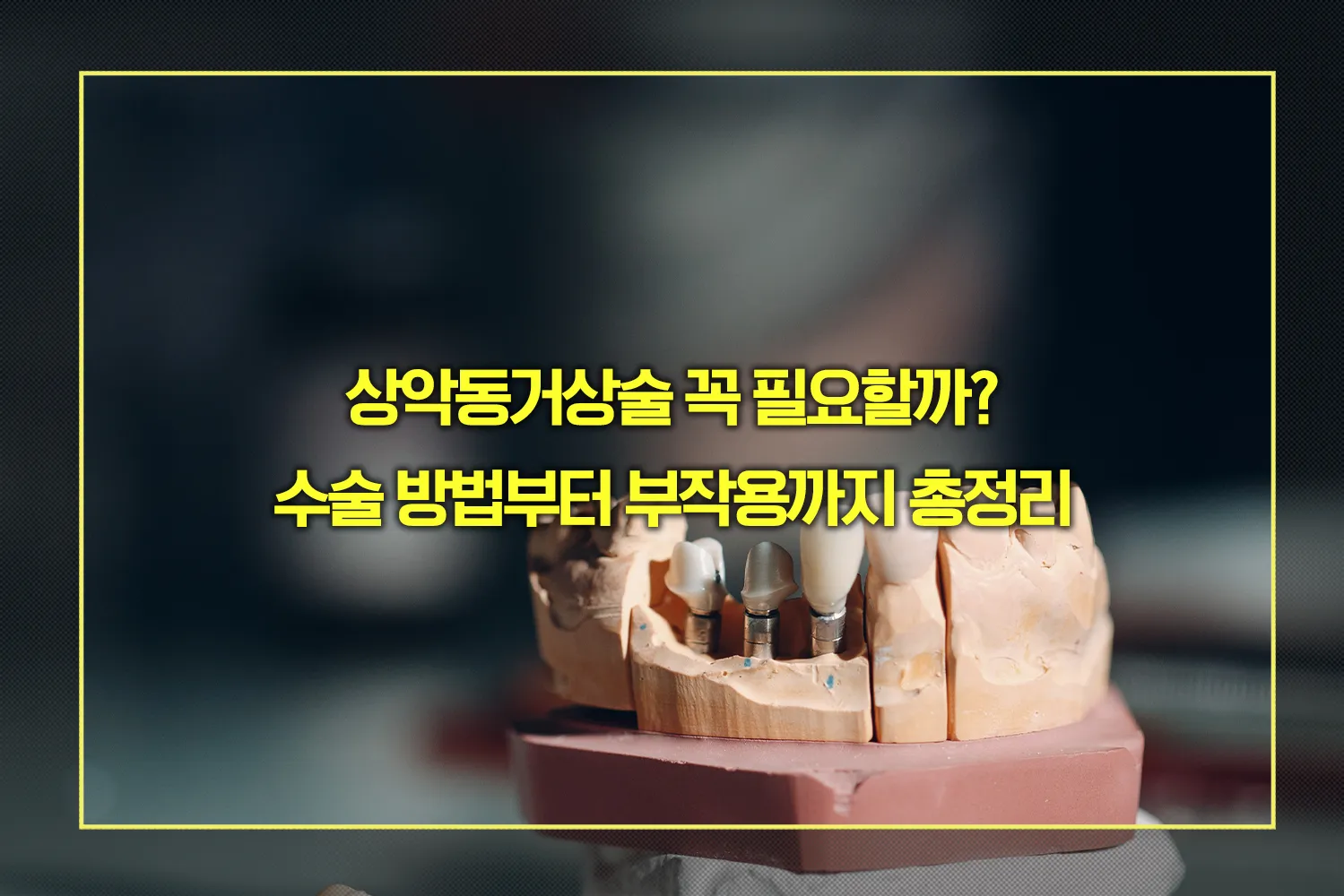 상악동거상술 수술 방법, 부작용