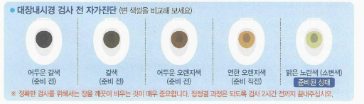 대장내시경