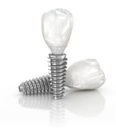 국산 임플란트 종류