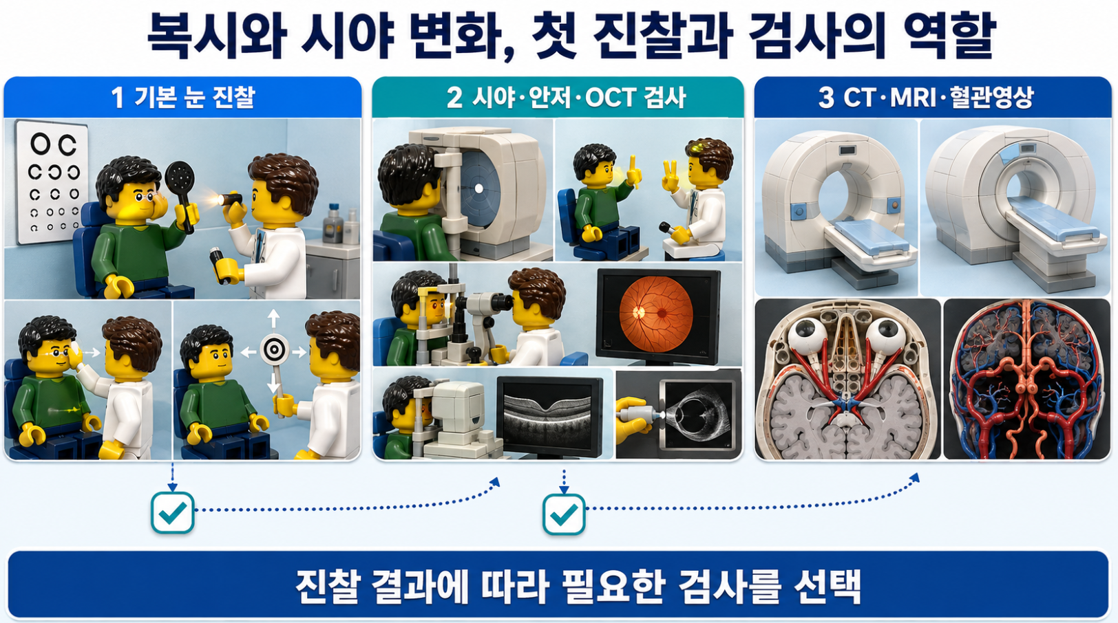 복시와 시야 변화의 기본 눈 진찰부터 시야&middot;안저&middot;OCT 및 CT&middot;MRI&middot;혈관영상 선택 과정