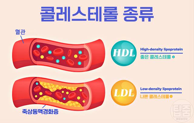 사과 매일 먹으면 콜레스테롤 사과 효능 부작용