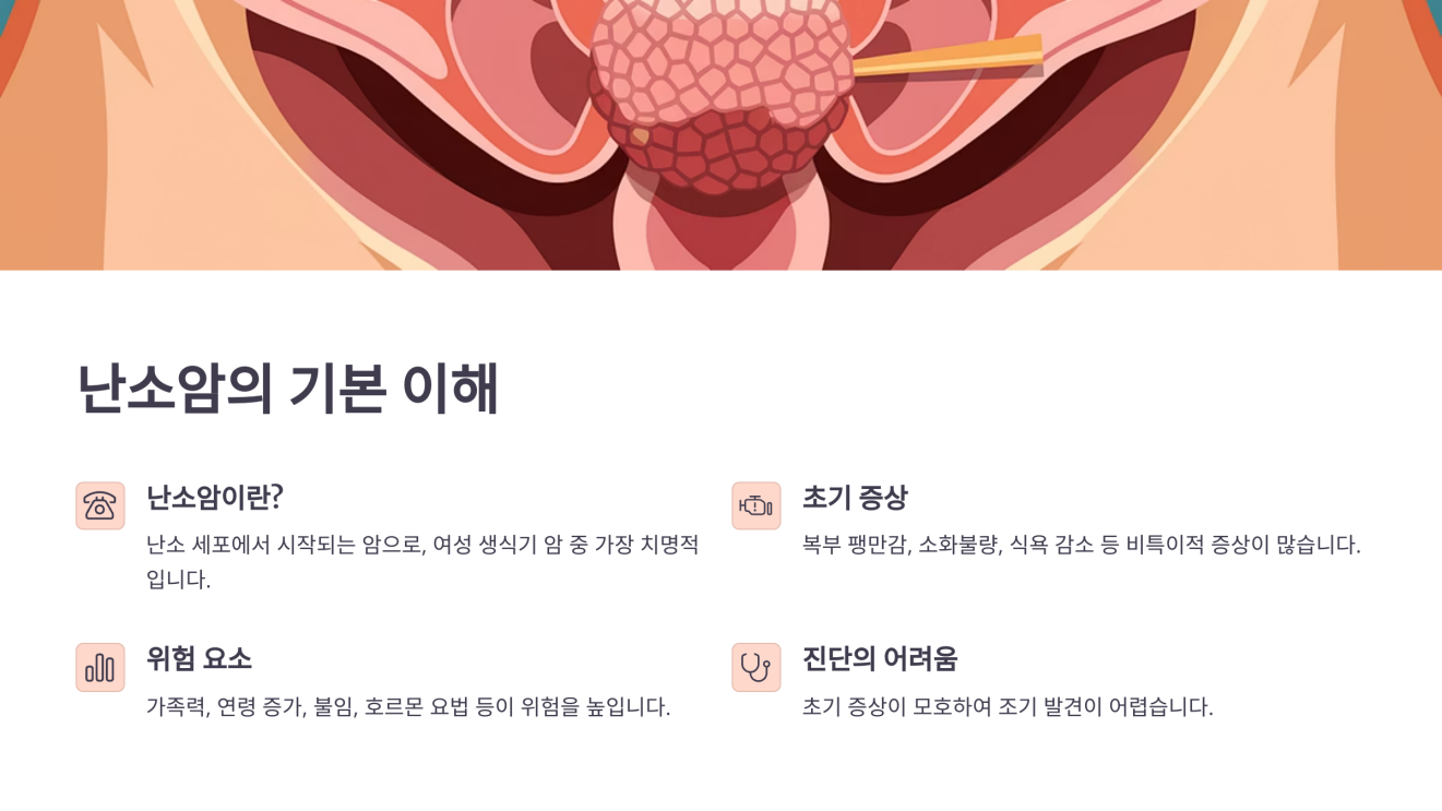 난소암 검사방법 2