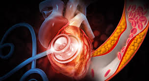 고혈압 낮추는 방법 10가지