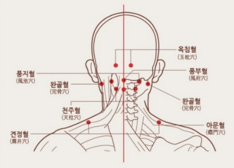 인체의 365혈 중에 인체의 뒷목에 있는 혈자리인 옥침, 풍부, 완골, 아문, 견정, 천주, 완골, 풍지의 위치를 빨간 점으로 해부학적 이미지에 표시를 한 사진