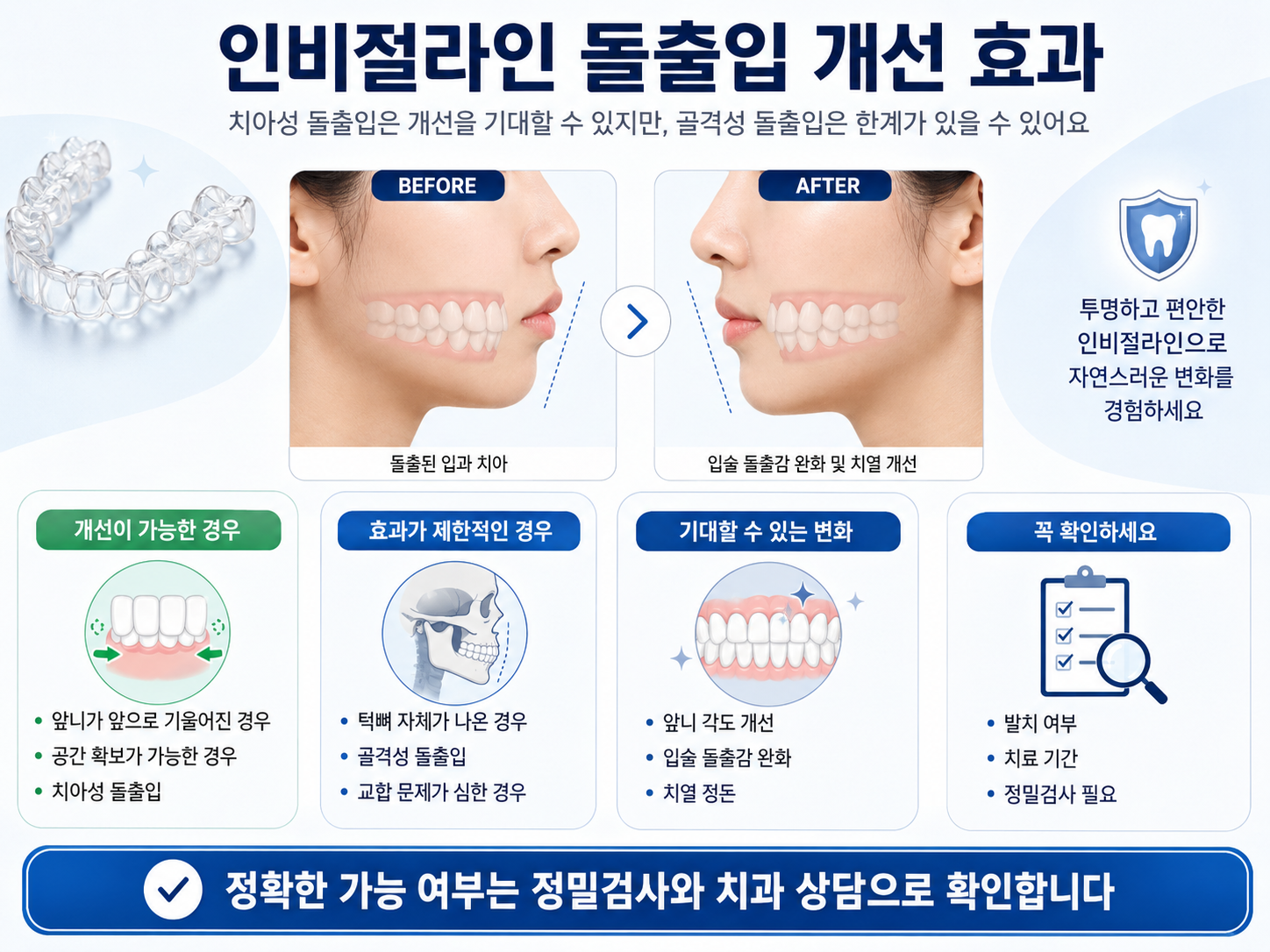 인비절라인 돌출입 개선 효과