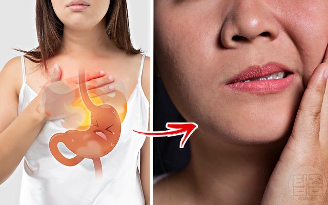 이갈이 원인 위산역류