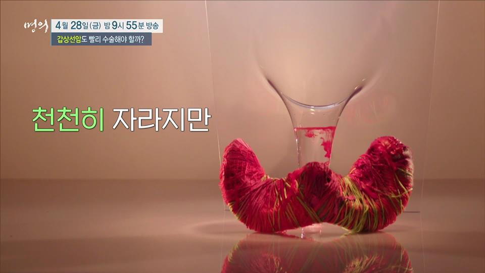 명의 갑상선 기능 항진증, 저하증 이어 발병한 결절, 갑상선암 검사 비용 방법