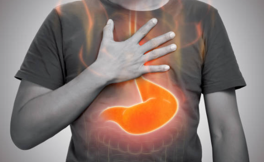 역류성 식도염 증상