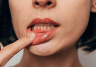 잇몸 염증 치료약