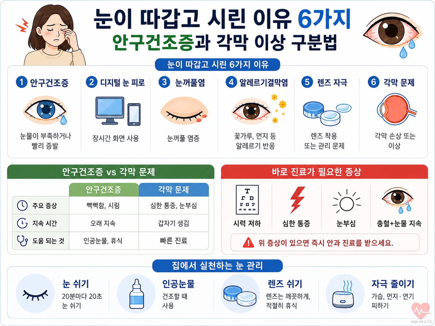 안구건조증과 각막염의 6가지 차이점