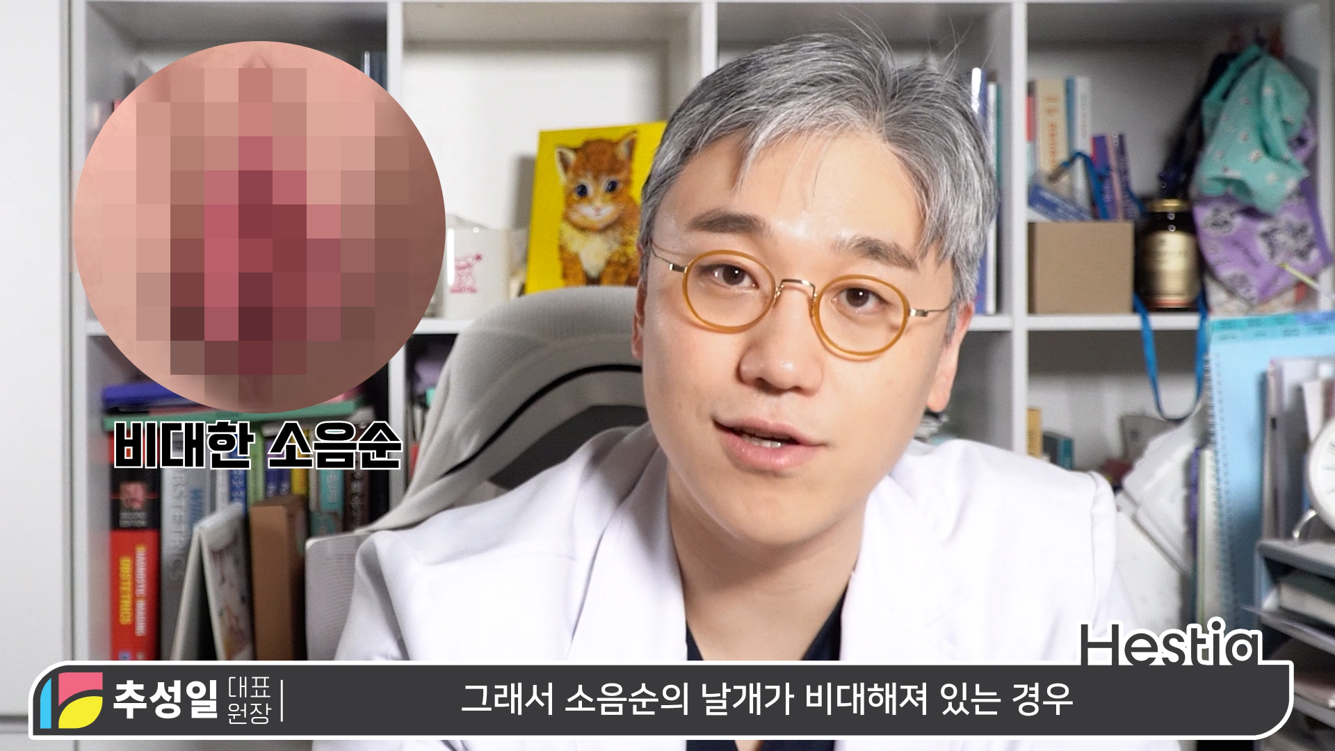 소음순변형은 '이런' 경우가 있습니다.