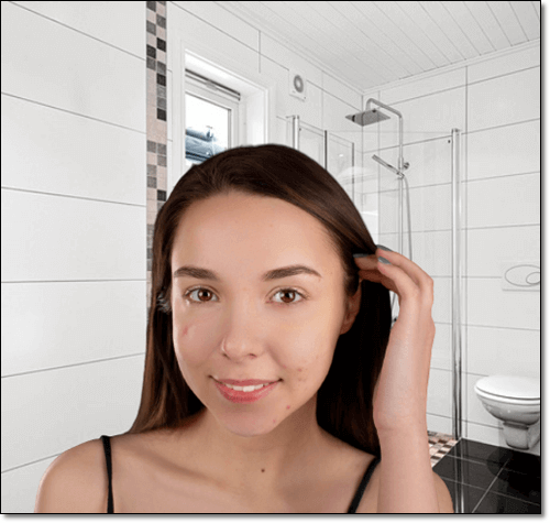 여드름이 생긴 여성