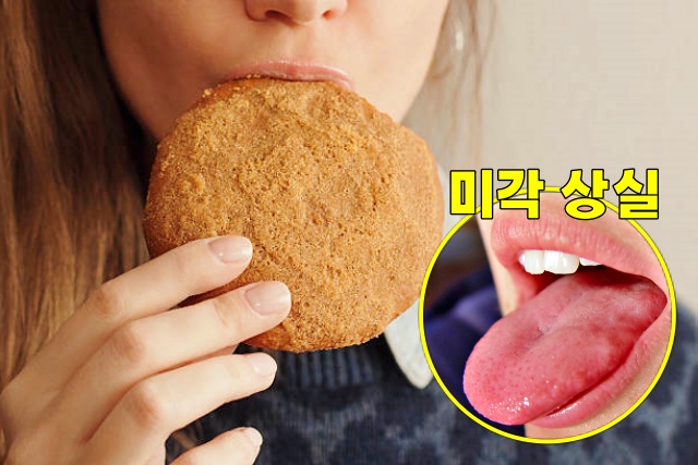 30대 여성 남성 미각상실 후각상실, 건강 팁줌 매일꿀정보