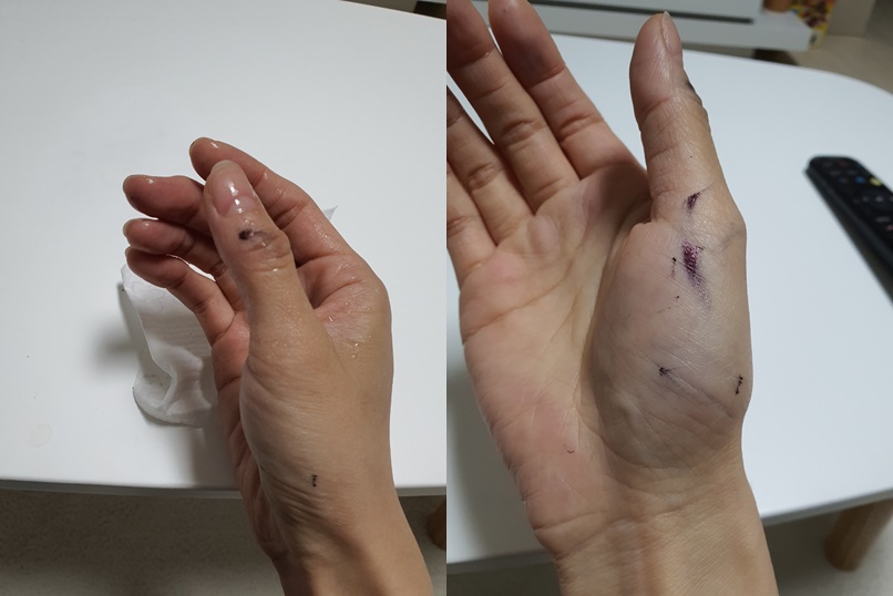 볼펜-잉크-지우기